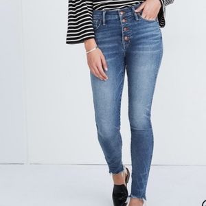 Madewell 10" Button Fly High Rise Skinny Jeans